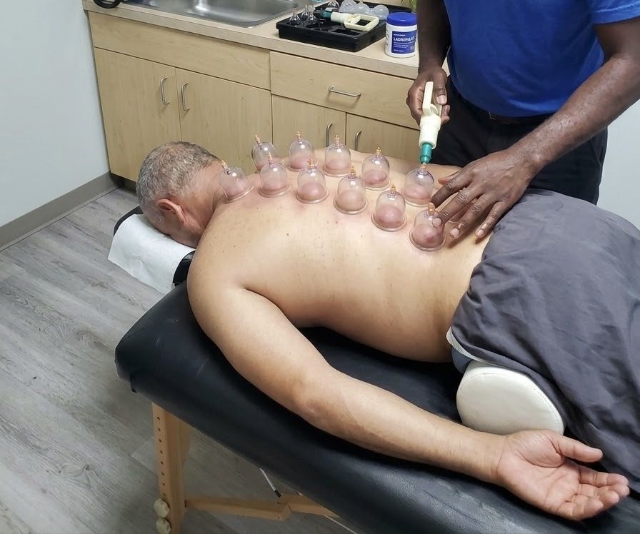 Cupping therapy on a client's back at FLUX
